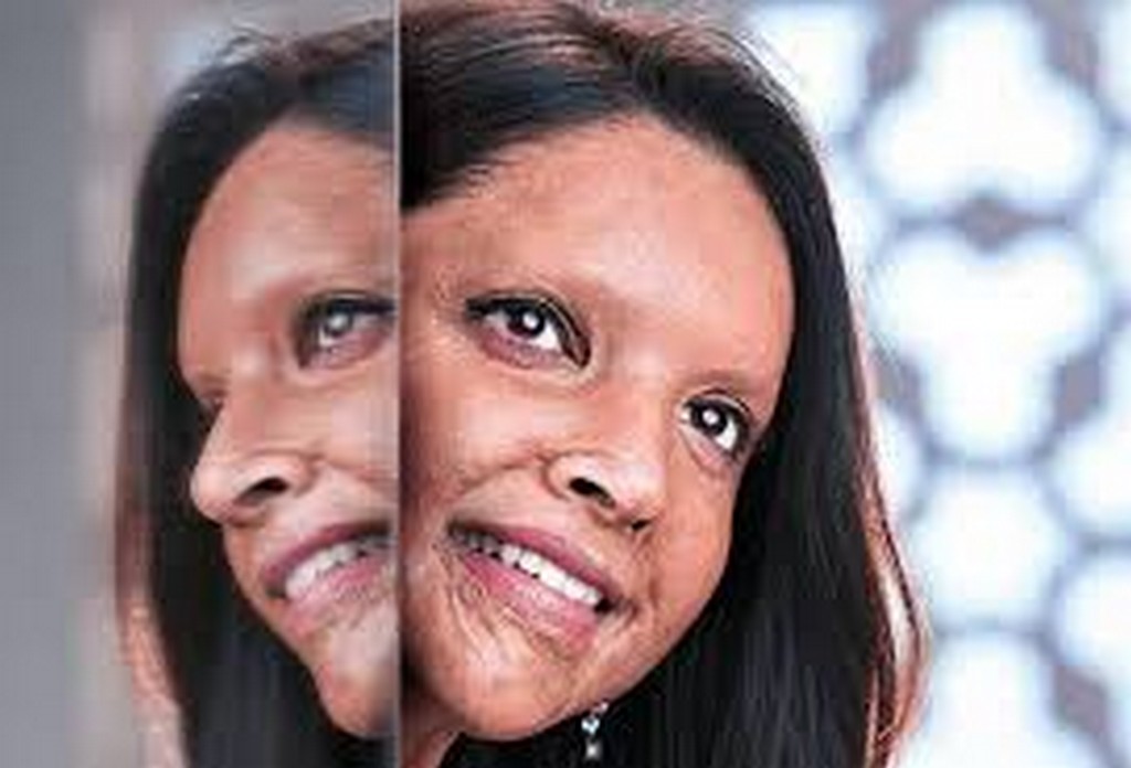 CHHAPAAK