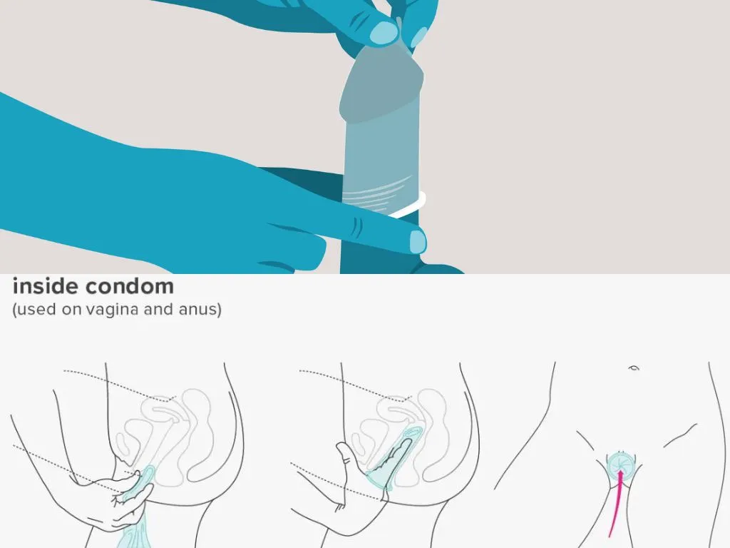 Condoms for Men and Women