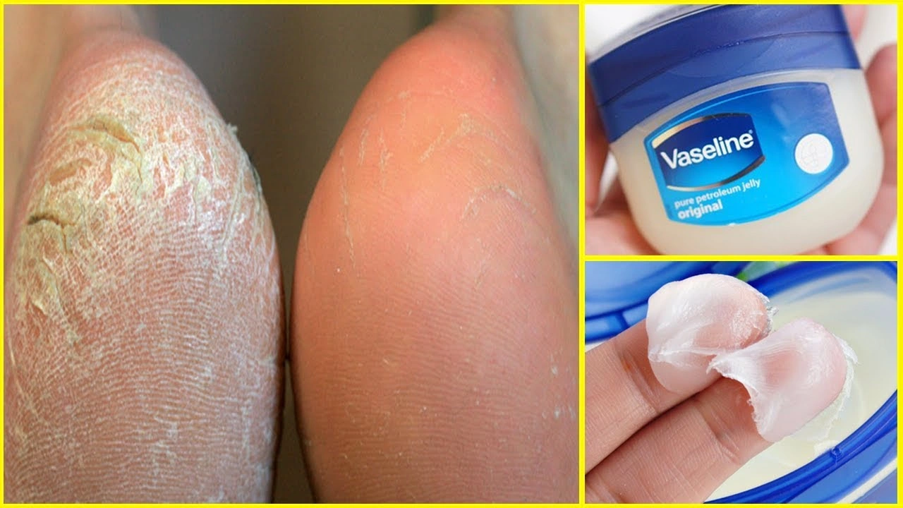 Top 10 Vaseline Hacks You Must Know For Everyday Life